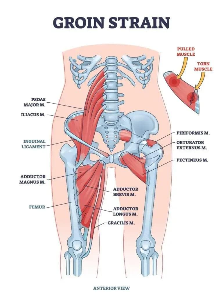 Injury Info