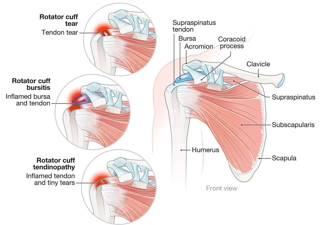 Injury Info